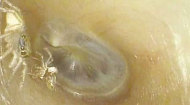 SVRBELO JE UVO DO BESVESTI, OTIŠLA U BOLNICU, A TAMO ŠOK: Kada su videli šta je unutra nisu mogli da veruju svojim očima! (FOTO)