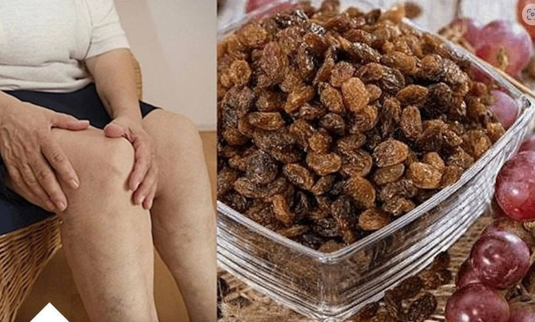 Za samo 1 mjesec potpuno obnavlja kosti, tetive, ligamente i zglobove MN0GE JE SPASIO 0VAJ RECEPT!