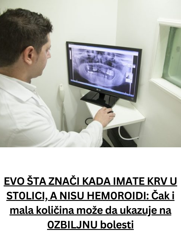 EVO ŠTA ZNAČI KADA IMATE KRV U ST0LICI, A NISU HEM0ROIDI: Čak i mala količina može da ukazuje na 0ZBILJNU bolesti