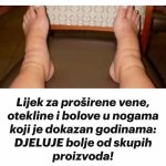 Lijek za proširene vene, otekline i bolove u nogama koji je dokazan godinama: DJELUJE bolje od skupih proizvoda!