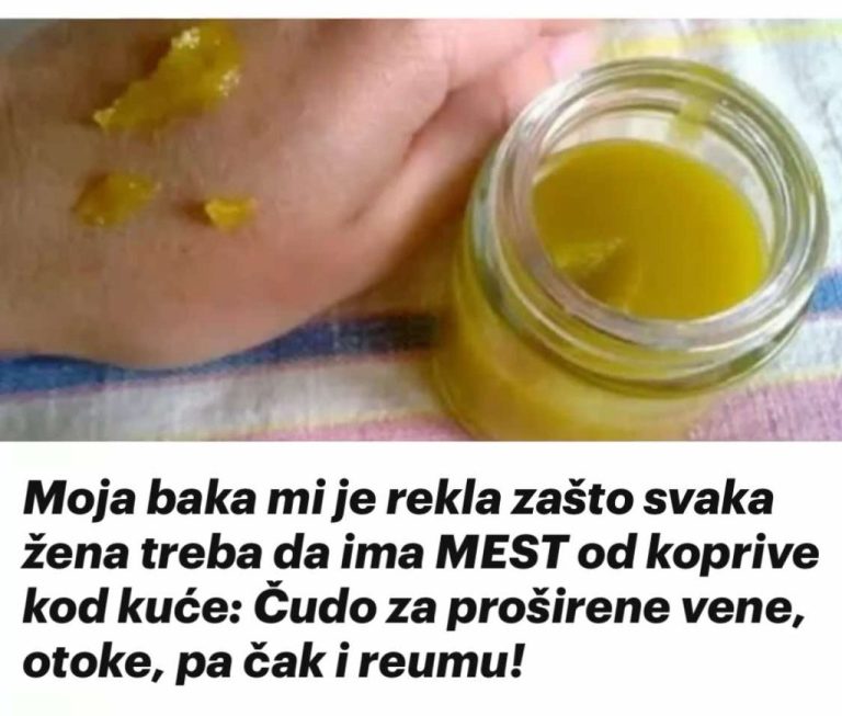 Moja baka mi je rekla zašto svaka žena treba da ima MEST od koprive kod kuće: Čudo za proširene vene, otoke, pa čak i reumu!