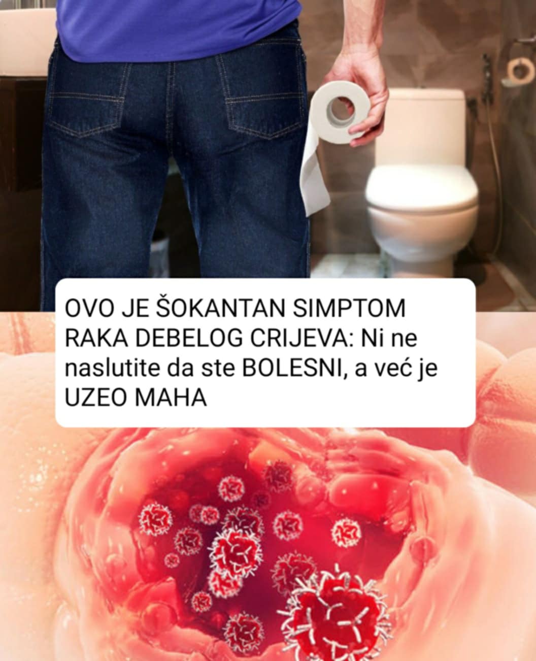 OVO JE Š0KANTAN SIMPT0M RAKA DEBELOG CRIJEVA: Ni ne naslutite da ste BOLESNI, a već je UZEO MAHA