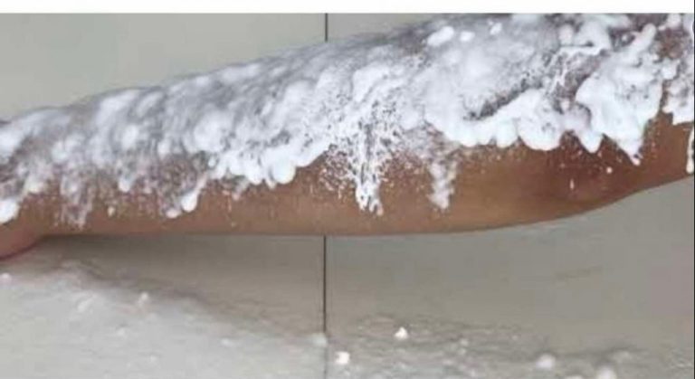 Prestanite da se brijete: Ova žena vam pokazuje TRIK kako da se riješite neželjenih dlačica na tijelu i bikiniju!