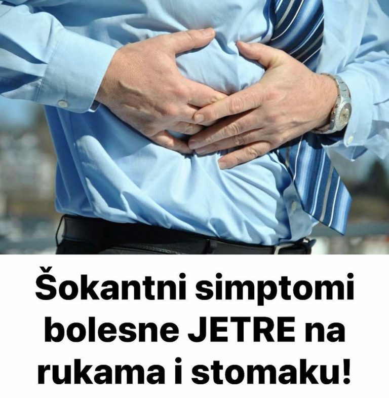 Š0kantni simptomi b0lesne JETRE na rukama i stomaku!
