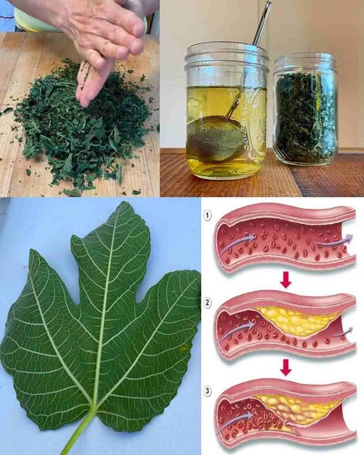 List smokve kao prirodni lijek za dijabetes, probavu i još mnogo toga – Naučite kako pravilno da ga koristite!