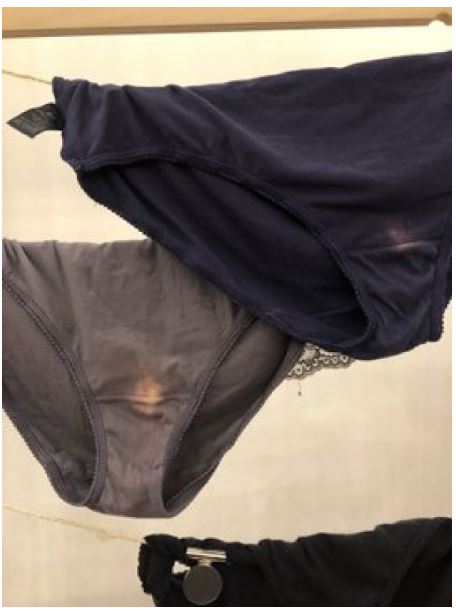 Znate li zbog čega vam se pojavljuju žute mrlje na donjem vešu?Ovo morate da znate!!!!!!