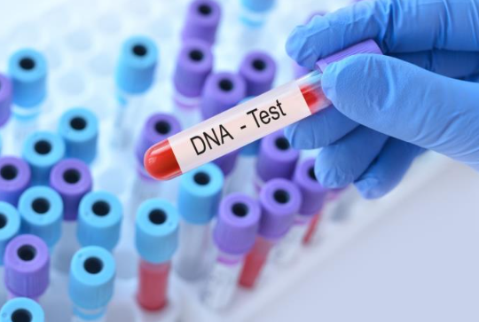 NAJČEŠĆI SIMPTOMI RAKA BUBREGA: Stručnjak upozorava na šta bi trebalo da obratite pažnju i koji su načini prevencije