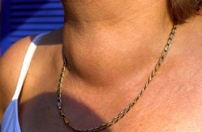 Za kafu smo svi znali, ali i ovo povrće je najgore za štitnu žlezdu: Zaboravite na njega odmah, može da dovede do..