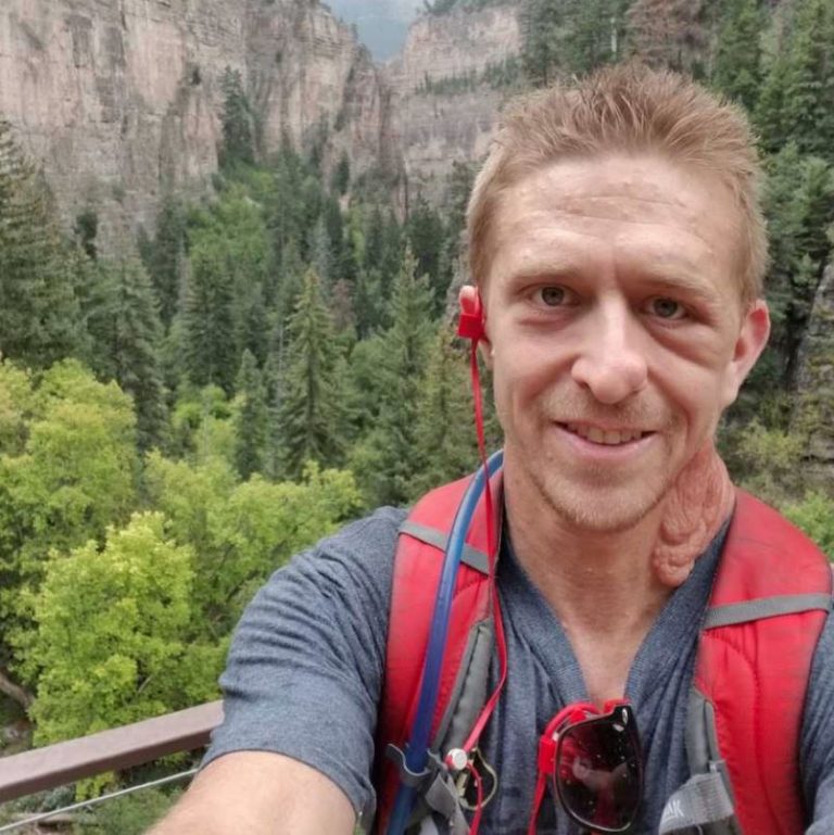 Bio je sasvim običan dečak, a onda je sa 6 godina počeo da primećuje promene na svojoj koži: “Deca su upirala prstom u mene, mislili da sam zarazan i bežali”