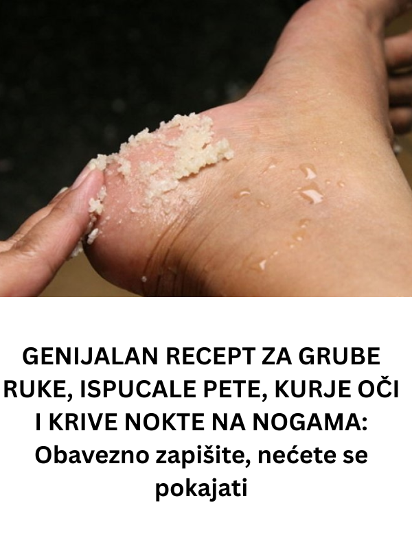 GENIJALAN RECEPT ZA GRUBE RUKE, ISPUCALE PETE, KURJE OČI I KRIVE NOKTE NA NOGAMA: Obavezno zapišite, nećete se pokajati