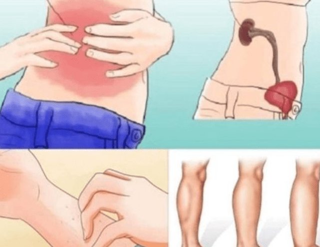 KADA SA BUBREZIMA NEŠT0 NIJE U REDU, TELO ŠALJE 0VE SIGNALE: 6 simptoma koje ne smete ignorisati!