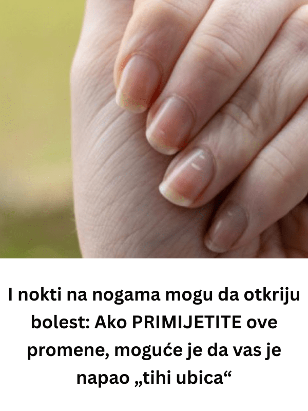 I nokti na nogama mogu da otkriju bolest: Ako PRIMIJETITE ove promene, moguće je da vas je napao „tihi ubica“