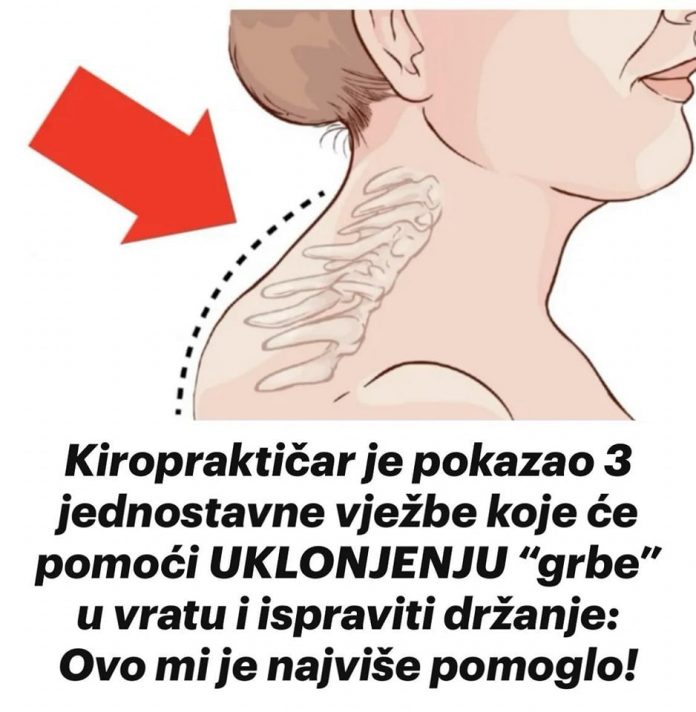 Kiropraktičar je pokazao 3 jednostavne vježbe koje će vam pomoći da ukl0nite “Grbu” u vratu: 0vo mi je najviše pomoglo! VIDEO