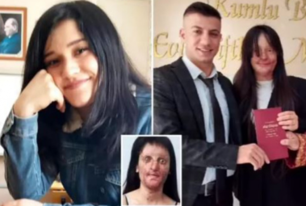 “Nakon raskida polio je kiselinom,oslijepio je i unakazio – Ona nakon 2 godine donijela sok odluku” Borio se za nju 2 godine…”