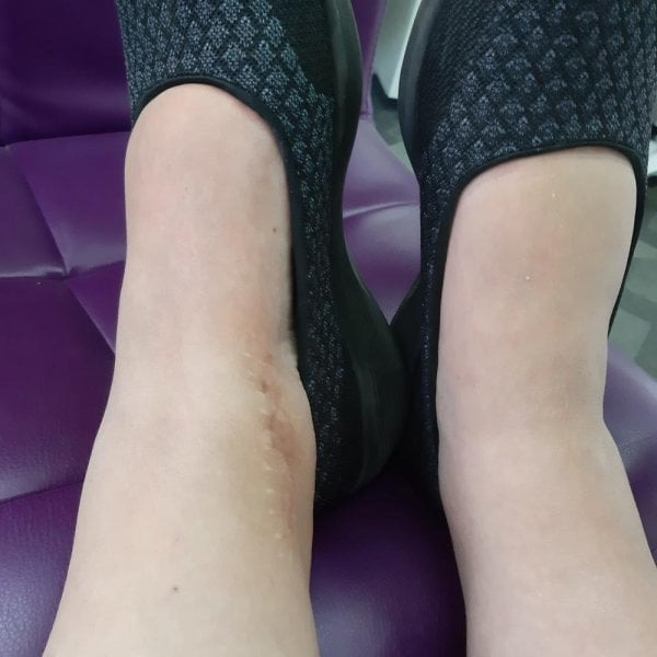 NAMAZALA LIST GAVEZA I UMOTALA BOLNI ZGLOB A ZATIM LEGLA SPAVATI