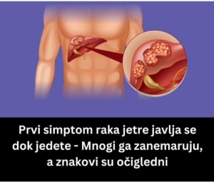 Prvi simptom raka jetre javlja se dok jedete – Mnogi ga zanemaruju, a znakovi su očigledni