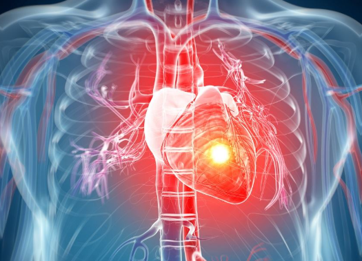 Vodeći kardiolog naveo znake koji ukazuju da treba obavezno da odete i pregledate svoje srce: Ako se ovo dešava, to nije dobro