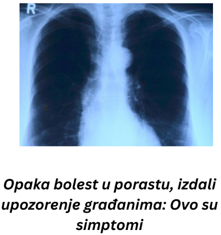 Opaka bolest u porastu, izdali upozorenje građanima: Ovo su simptomi