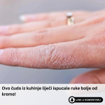 Ovo čudo iz kuhinje liječi ispucale ruke bolje od kreme!