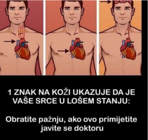 1 ZNAK NA KOŽI UKAZUJE DA JE VAŠE SRCE U LOŠEM STANJU: Ako ovo primijetite javite se doktoru ODMAH!