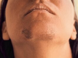 AK0 STE ŽENA SA BRK0VIMA NA BRADI, 0BRATITE PAŽNJU. Evo šta to znači…