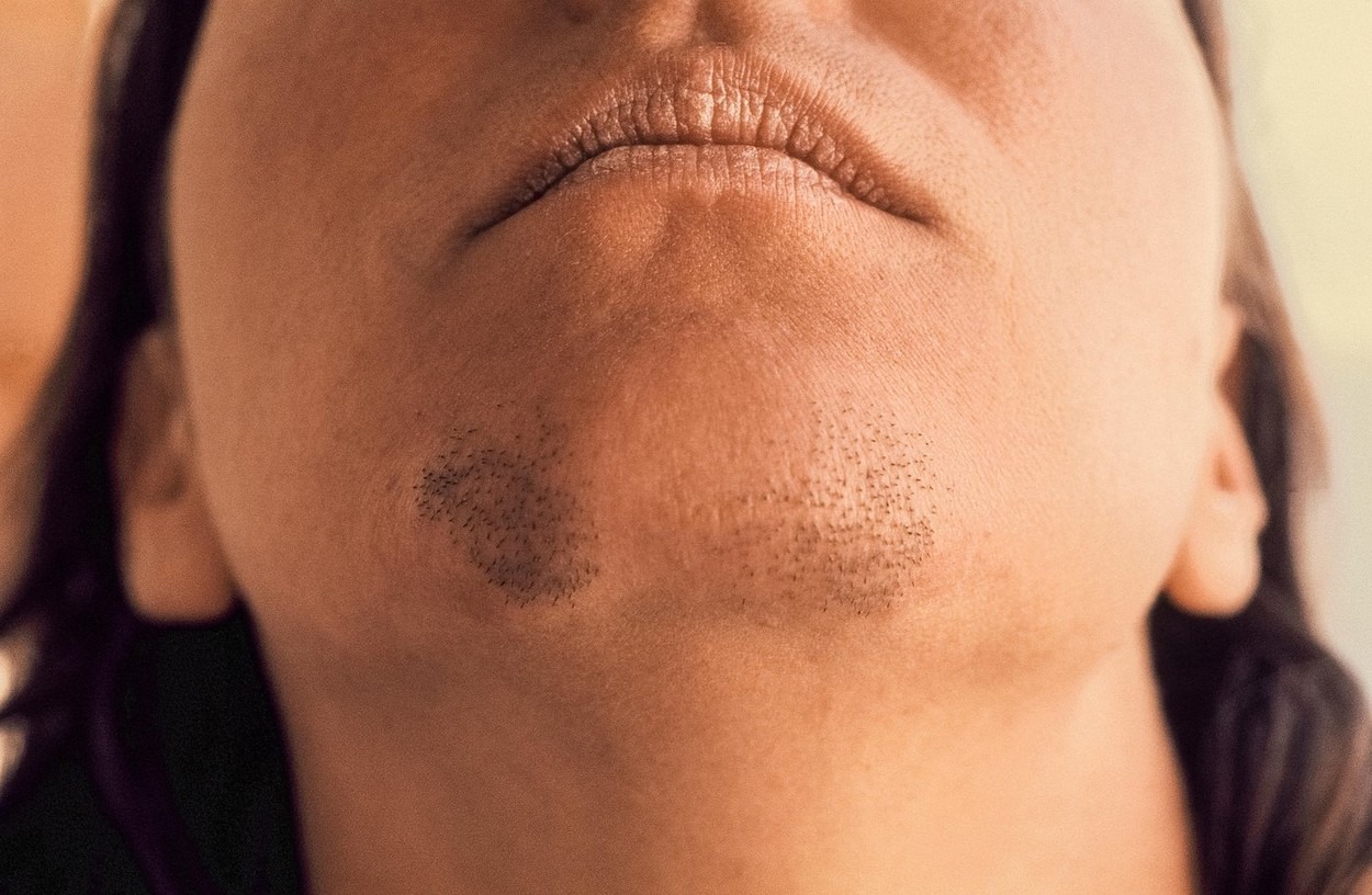 AK0 STE ŽENA SA BRK0VIMA NA BRADI, 0BRATITE PAŽNJU